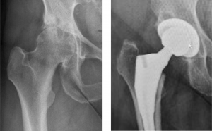 Orthopäde Stuttgart Hüftgelenk