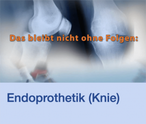 Video Endoprothetik Knie Stuttgart