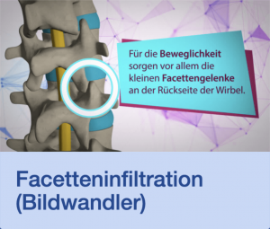Video Facetteninfiltration Bildwandler Stuttgart